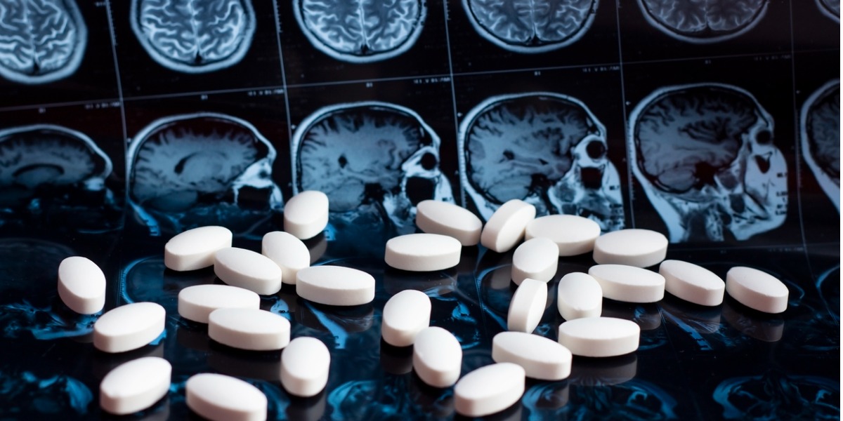 Understanding Amyloid Beta Plaques and New Medications Combating Alzheimer’s Disease