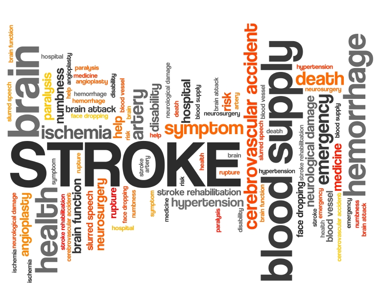 Stroke: The Facts on Treatment and Symptoms