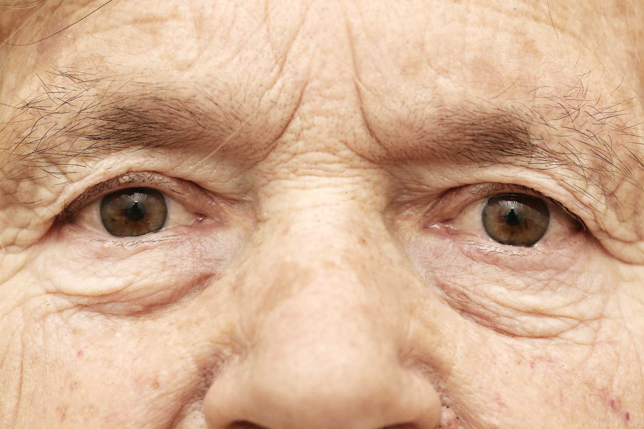 The Eyes – Our Window to Health