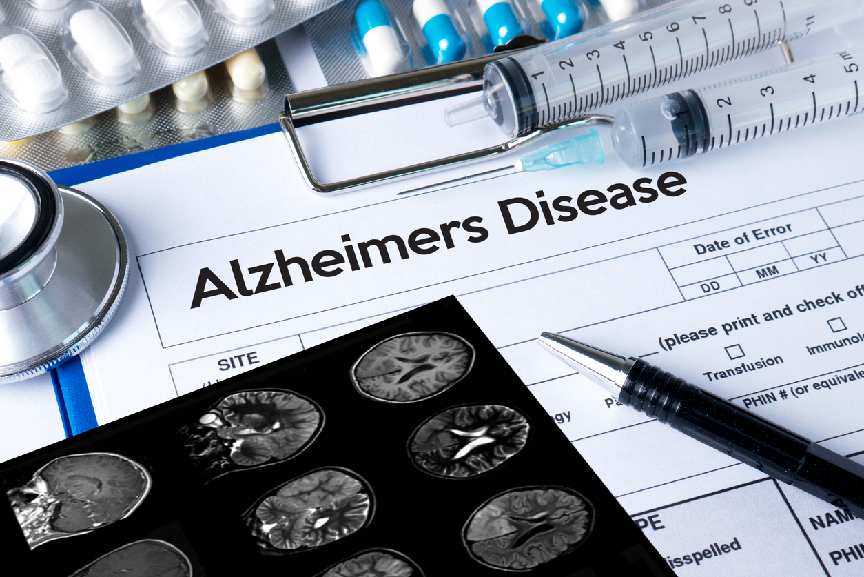 Alzheimer’s Resources and Support in Los Angeles