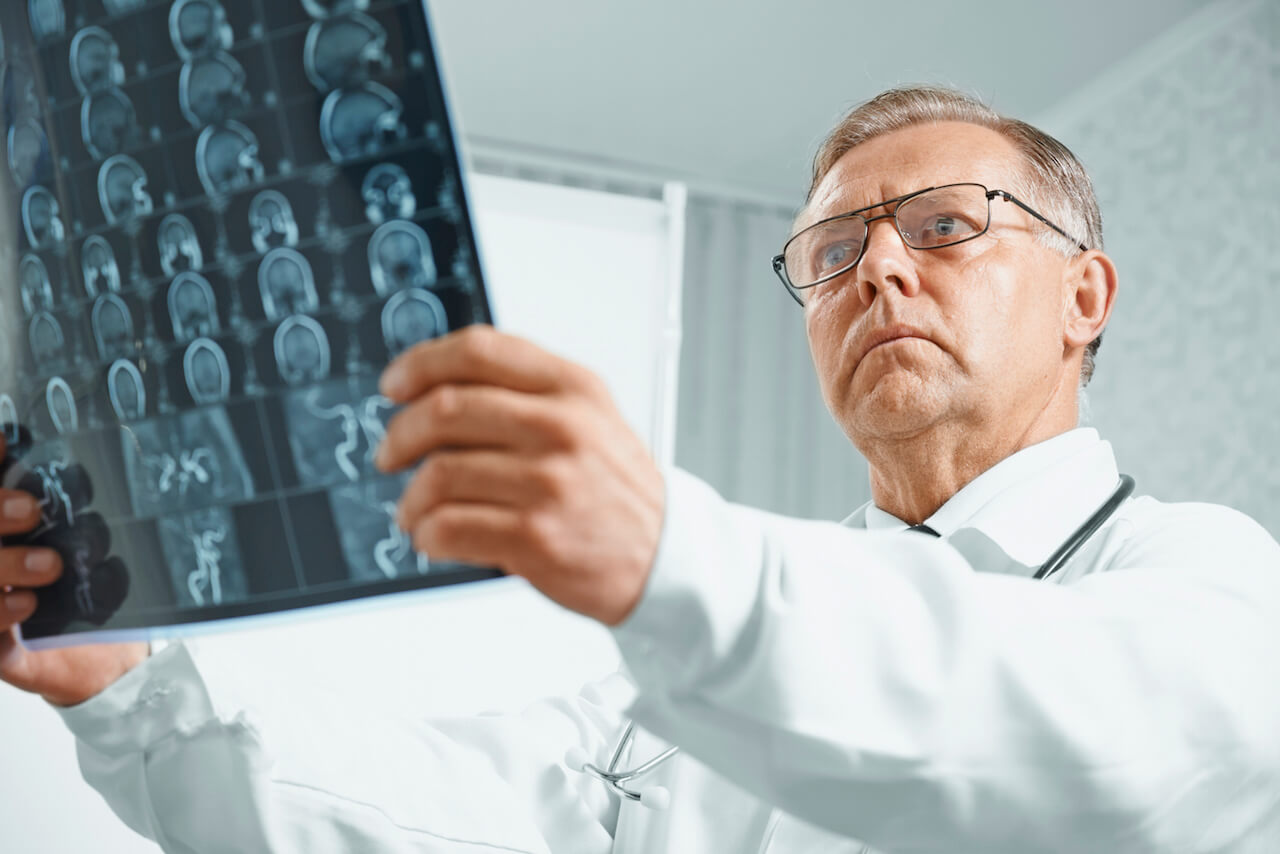 Alzheimer’s and Parkinson’s – Their Differences and Similarities