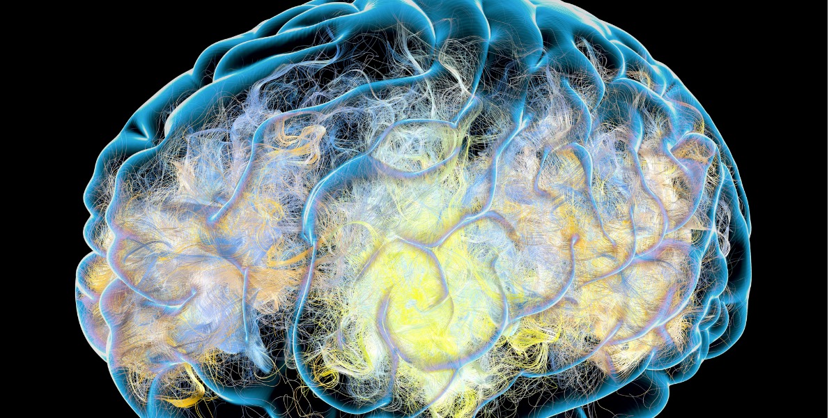 Reducing Your Risk of Alzheimer’s Disease